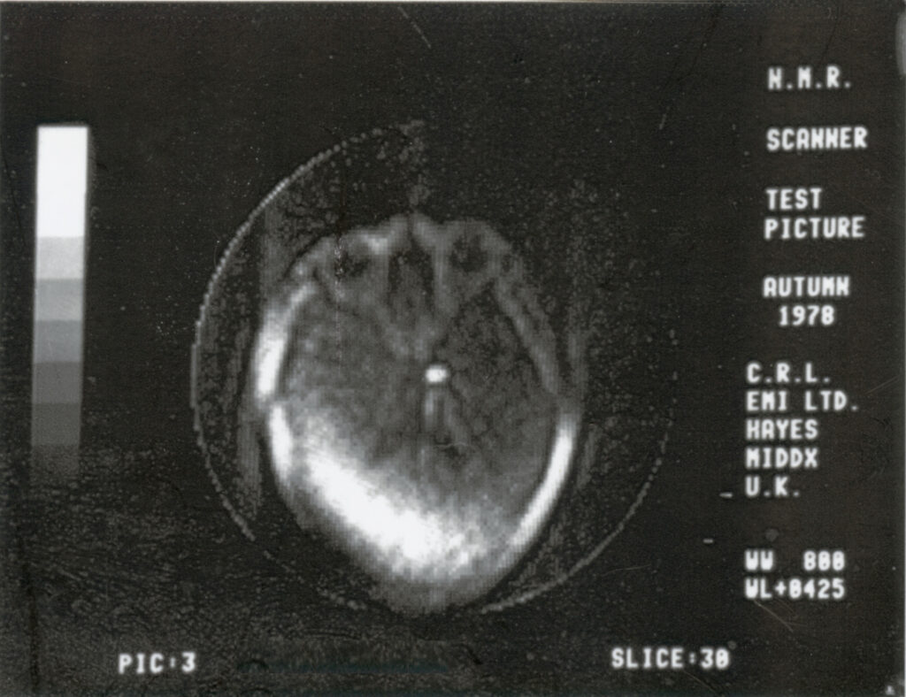 First MRI